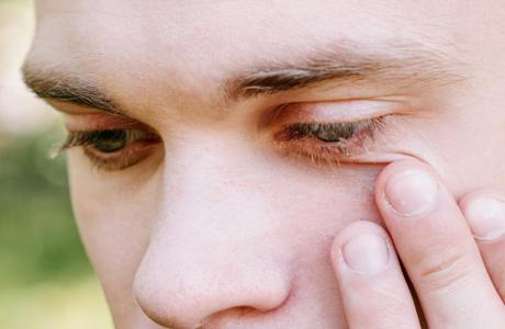 Infective Conjunctivitis